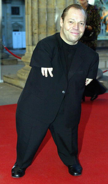 Caso de superação: O cantor de 1,29 m sem braços e coxas.