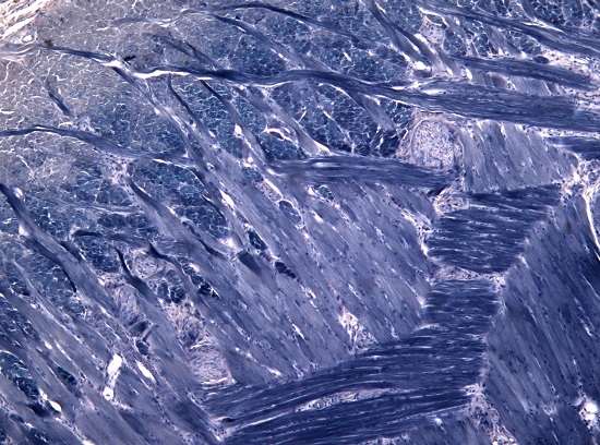 A imagem mostra um corte de língua corado com a substância hematoxilina fosfotúngstica. O nome da foto? Língua num mar azul, de Gisela Ramos Terçarioli. A imagem mostra um corte de língua corado com a substância hematoxilina fosfotúngstica. O nome da foto? Língua num mar azul, de Gisela Ramos Terçarioli.