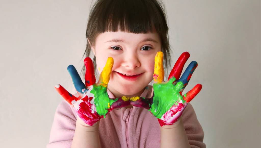 Pela 1ª vez um tratamento para síndrome de Down mostra eficácia