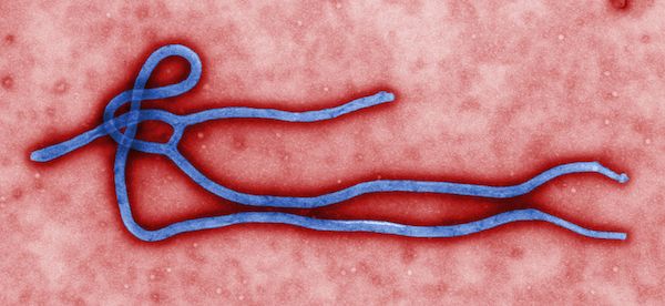 Cynthia Goldsmith This colorized transmission electron micrograph (TEM) revealed some of the ultrastructural morphology displayed by an Ebola virus virion. See PHIL 1832 for a black and white version of this image. Where is Ebola virus found in nature?The exact origin, locations, and natural habitat (known as the "natural reservoir") of Ebola virus remain unknown. However, on the basis of available evidence and the nature of similar viruses, researchers believe that the virus is zoonotic (animal-borne) and is normally maintained in an animal host that is native to the African continent. A similar host is probably associated with Ebola-Reston which was isolated from infected cynomolgous monkeys that were imported to the United States and Italy from the Philippines. The virus is not known to be native to other continents, such as North America.