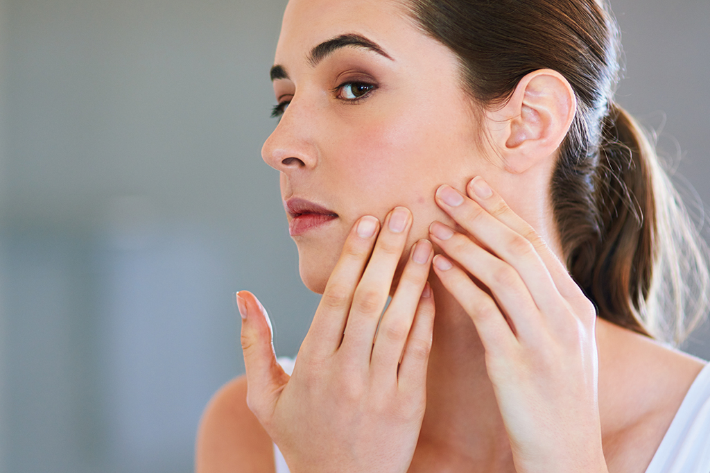 Cientistas criam novo tratamento anti-acne – sem efeitos colaterais
