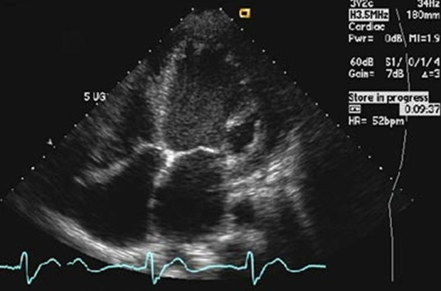 Qual é o limite máximo e o mínimo para os batimentos cardíacos?