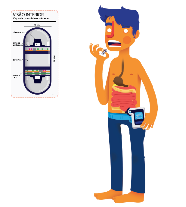 Como é a pílula com microcâmera?