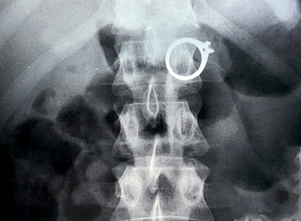 10 casos bizarros (e chocantes!) de crimes por dinheiro