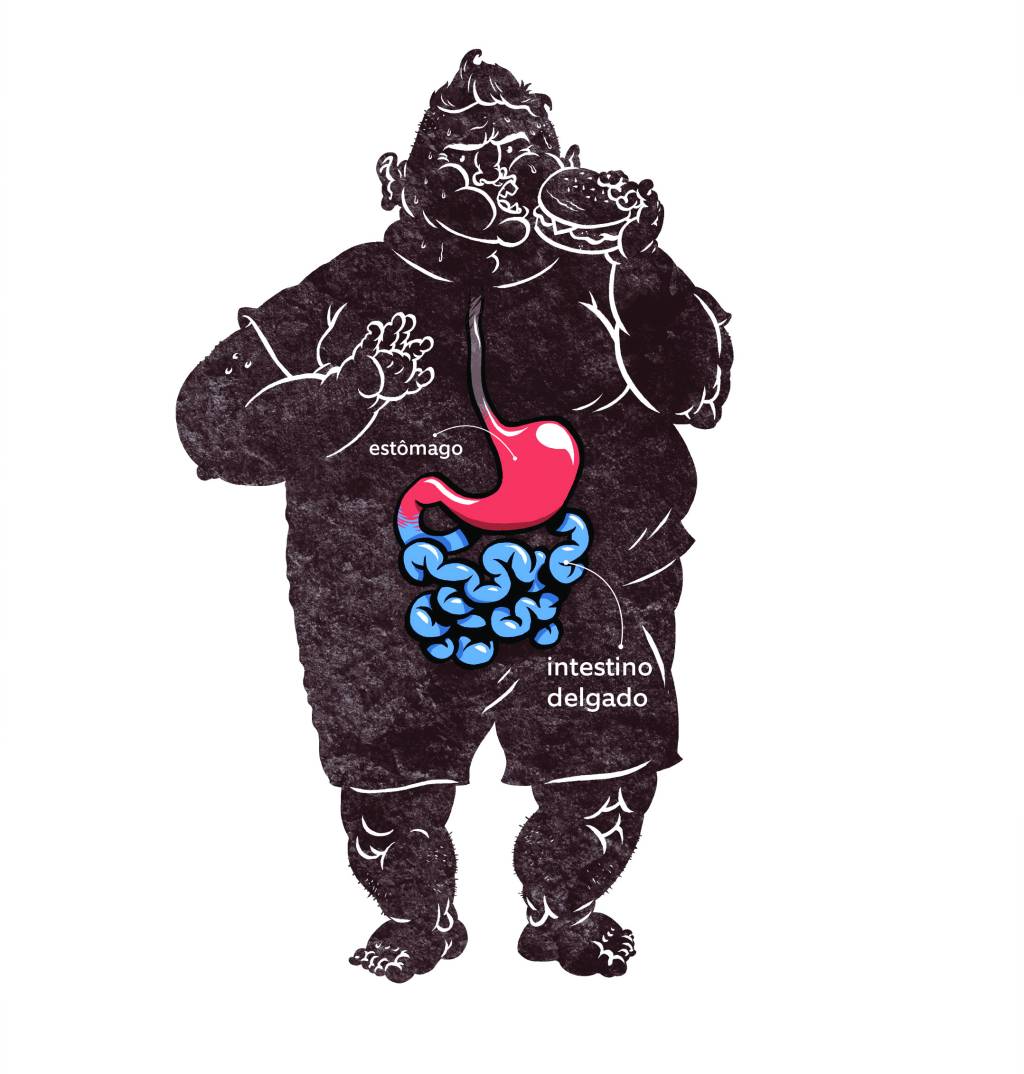 Quais os tipos de cirurgia de redução de estômago?