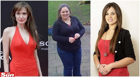 Mulher emagrece 70 quilos para ficar ‘mais parecida’ com Angelina Jolie