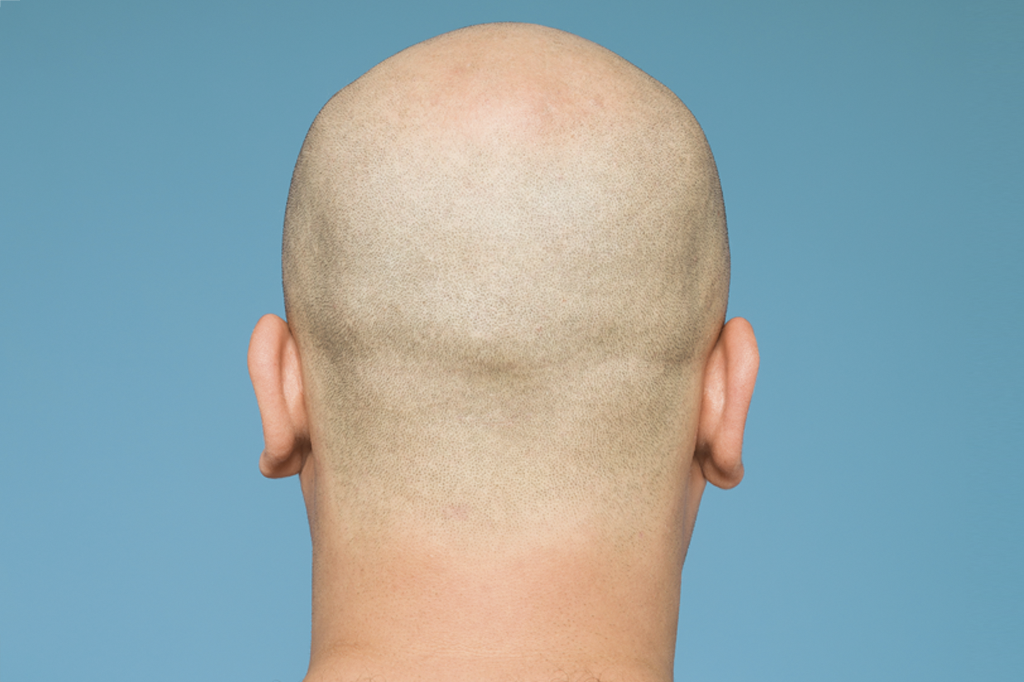 Por que temos de raspar o cabelo para entrar no Exército?