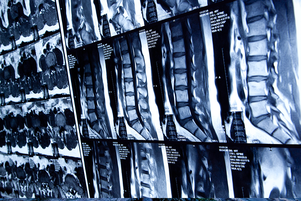 Nossa medula espinhal é mais “inteligente” do que a ciência pensava