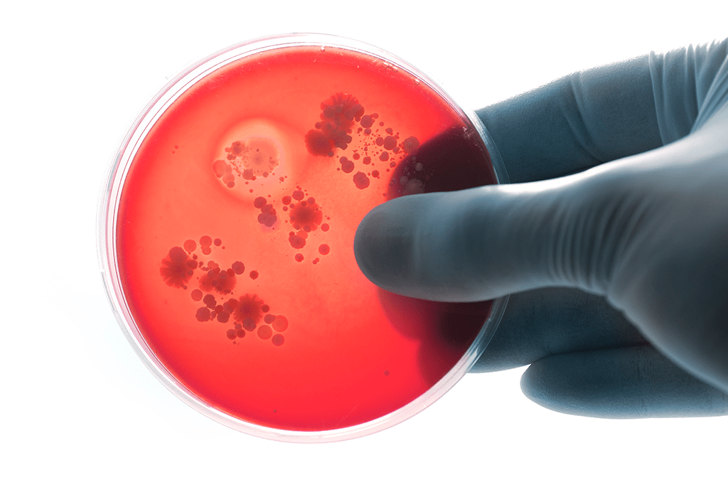 Cientistas descobrem composto que mata bactérias super-resistentes