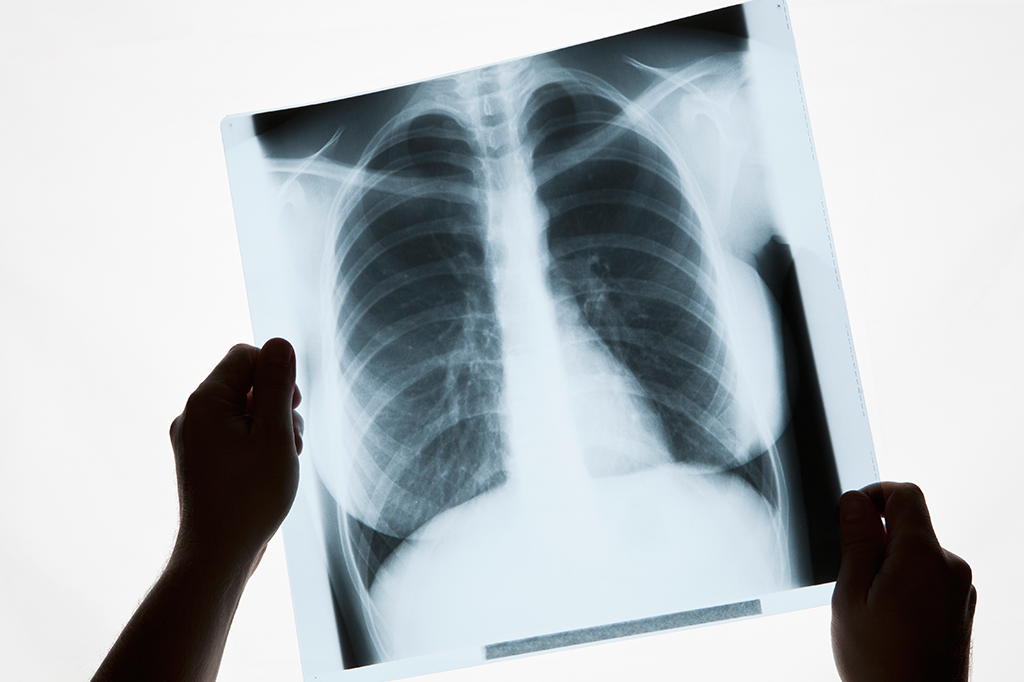 Como funciona uma máquina de raios X hospitalar?