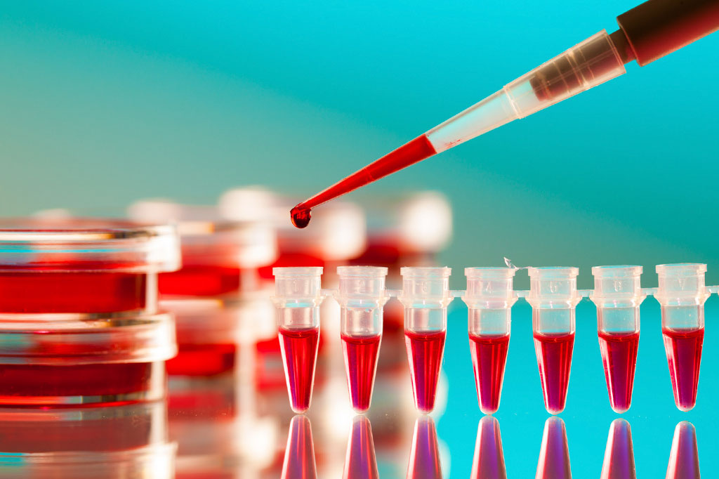 Quem é o segundo paciente curado de infecção por HIV