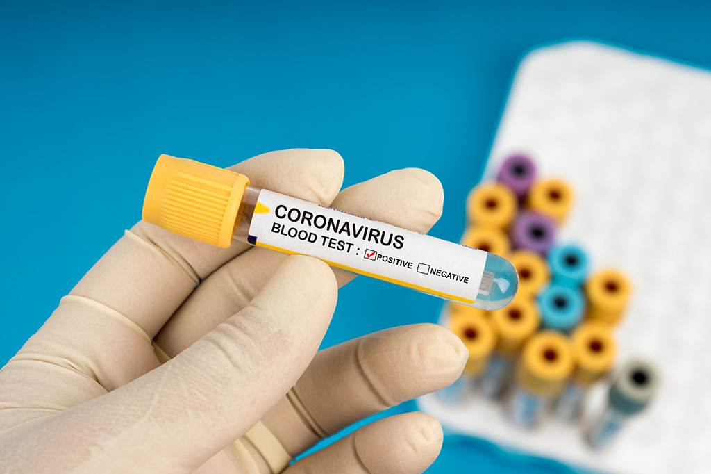 Pesquisa indica que 45% dos casos de Covid-19 podem ser assintomáticos