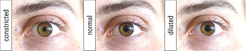 Alemão de 23 anos é capaz de contrair e dilatar as pupilas dos olhos, mostra estudo 2 Foto do olho de D.W. controlando sua pupila.