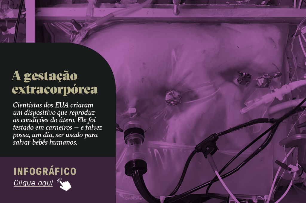 SI_449_utero-artificial_info1 Imagem de um carneiro em um dispositivo que reproduz as condições do útero, ao lado de uma chamada para ampliar o infográfico que explicara com mais detalhes o processo.