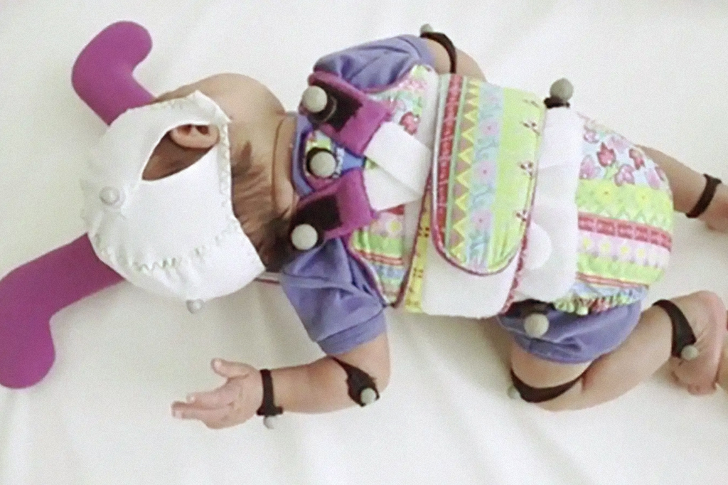 Skate adaptado pode ajudar bebês prematuros a desenvolver habilidades motoras