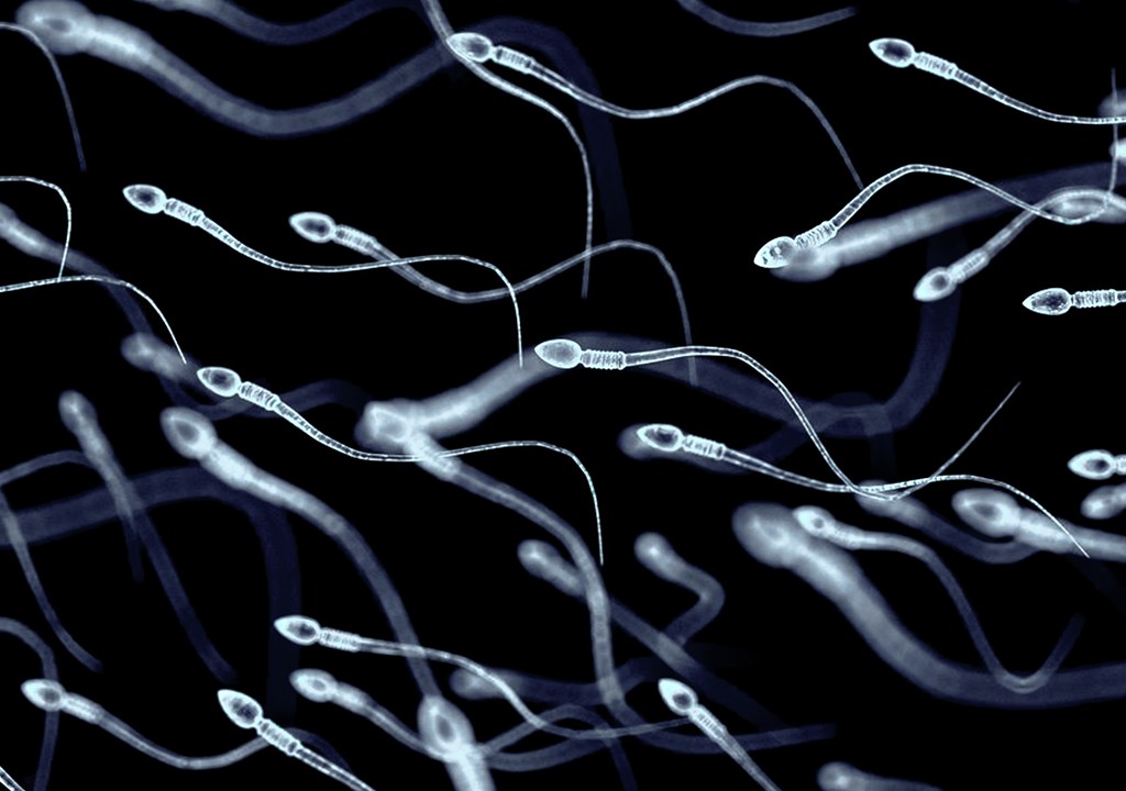 Vários espermatozóides.