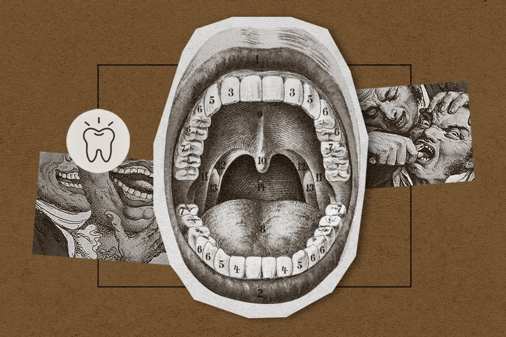 Colagem com ilustração antiga e pinturas que retratam procedimentos odontológicos antigos.