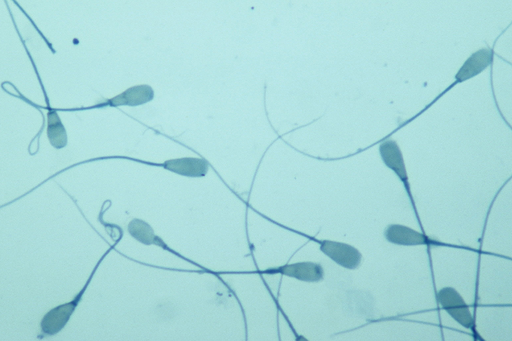 Espermatozoides vistos por um microscópio.