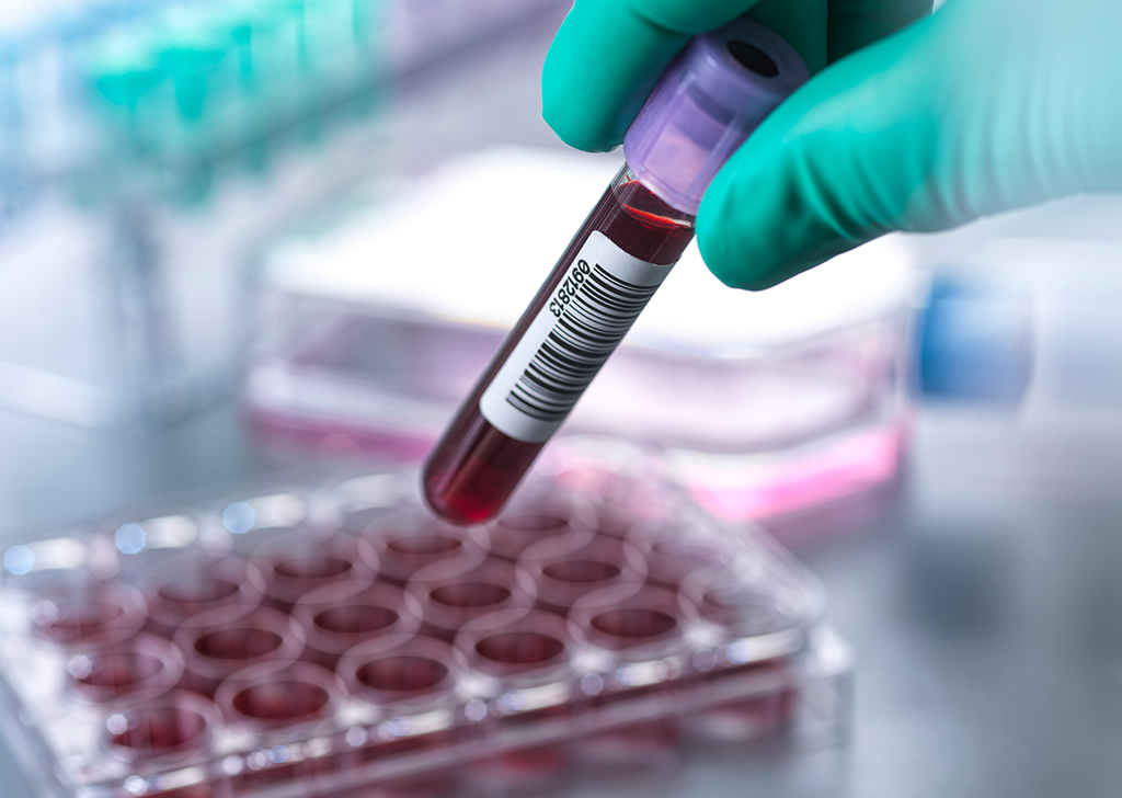 Pesquisador coletando amostra de sangue de uma prateleira de amostras médicas.