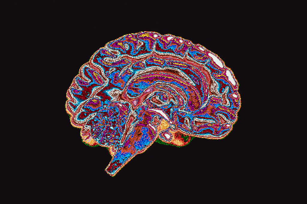 Sexo e gênero têm influências distintas no cérebro, sugere estudo