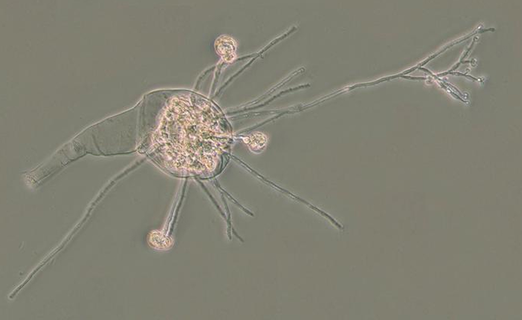 1707-dna-bacteria-super-site(2) Rotíferos bdeloides visto em microscópico.