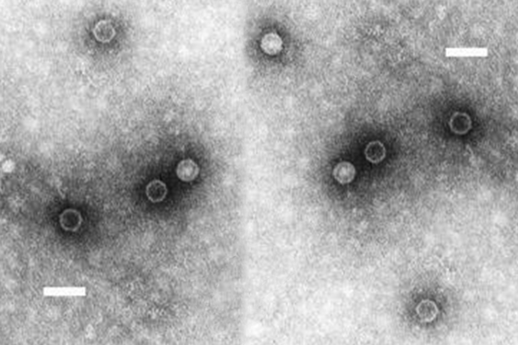 Detecção do vírus da poliomielite em esgotos da Europa intriga cientistas