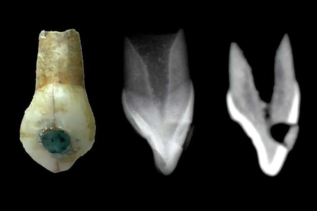 Crianças da civilização maia tinham piercing nos dentes, segundo arqueólogos