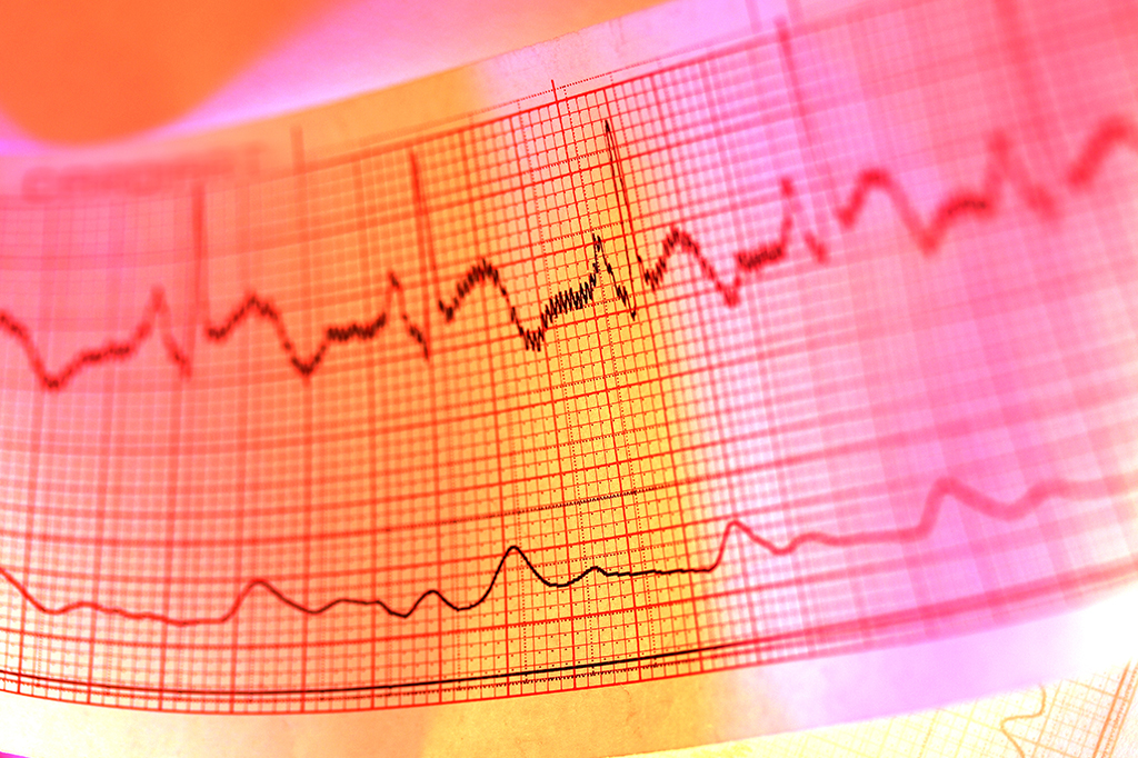 Qual é a quantidade normal de batimentos cardíacos? E quando fica fora do normal?